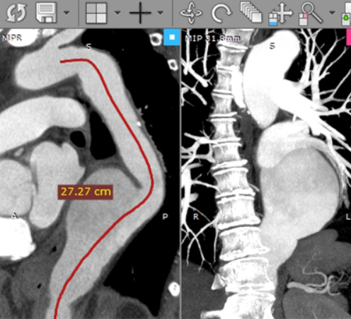 RadiAnt DICOM Viewer(u533bu5b66u56feu7247u6d4fu89c8u5668) 